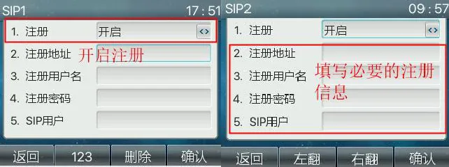 Aktivieren der SIP-Registrierung